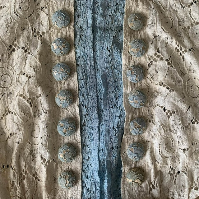 close up view of dress buttons 